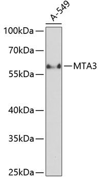 MTA3 Rabbit Polyclonal Antibody