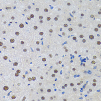 MTA3 Rabbit Polyclonal Antibody