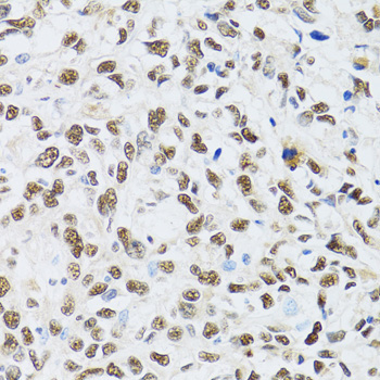 MTA3 Rabbit Polyclonal Antibody - Image 2