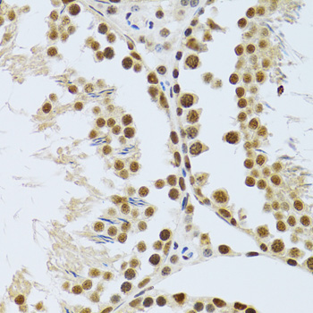 MTA3 Rabbit Polyclonal Antibody - Image 3