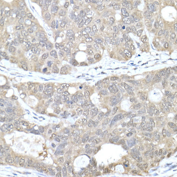 MTAP Rabbit Polyclonal Antibody - Image 3