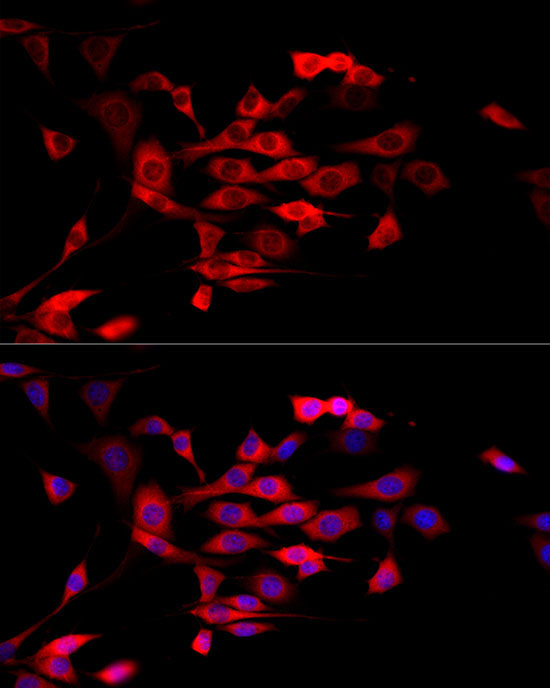 MTAP Rabbit Polyclonal Antibody - Image 7