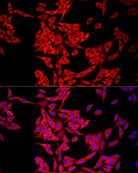 MTAP Rabbit Polyclonal Antibody - Image 8