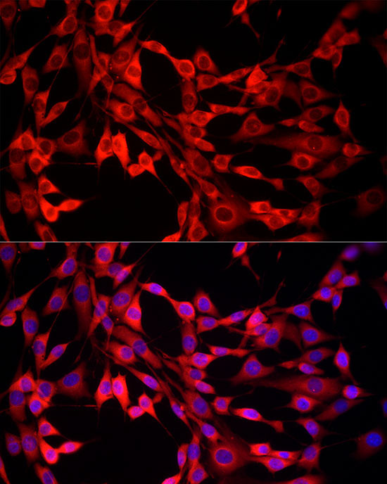 MTAP Rabbit Polyclonal Antibody - Image 3