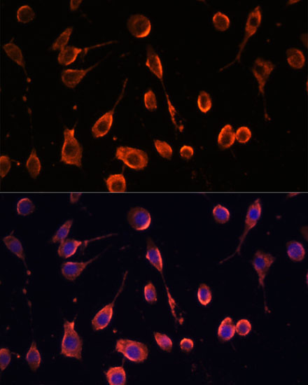 MT-ATP6 Rabbit Polyclonal Antibody