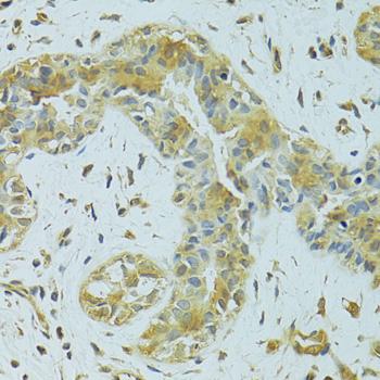 MTCH1 Rabbit Polyclonal Antibody - Image 2