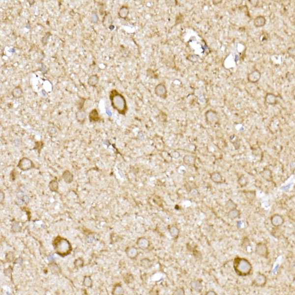 MTCO1 Rabbit Polyclonal Antibody - Image 4