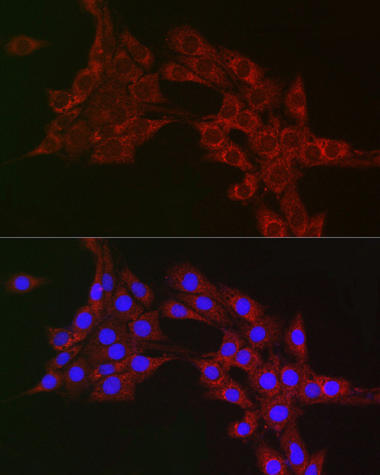 MTCO1 Rabbit Polyclonal Antibody - Image 6
