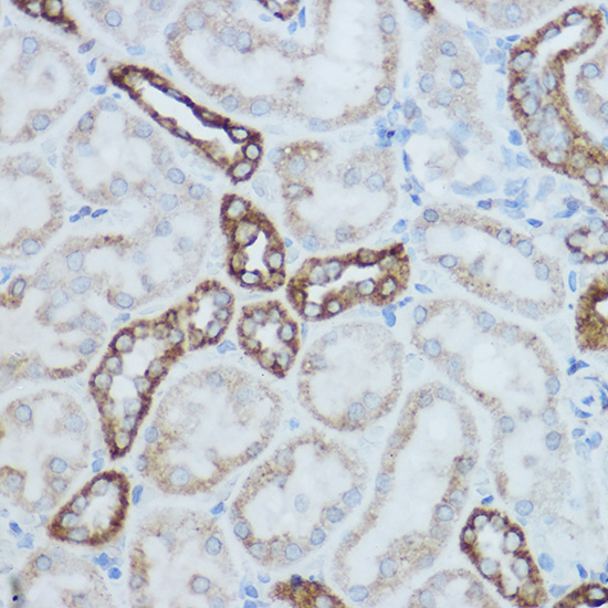MTCO2 Rabbit Polyclonal Antibody