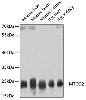 MTCO2 Rabbit Polyclonal Antibody