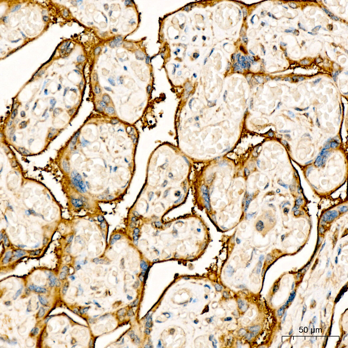 MT-CO3 Rabbit Polyclonal Antibody - Image 2