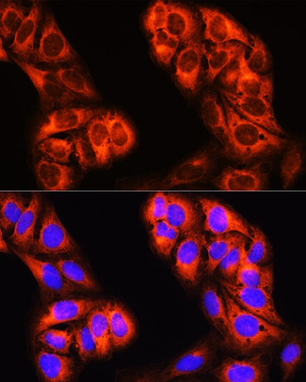 MTHFD1 Rabbit Polyclonal Antibody - Image 2