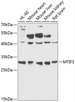 MTIF3 Rabbit Polyclonal Antibody