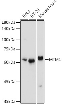 MTM1 Rabbit Polyclonal Antibody