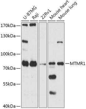 MTMR1 Rabbit Polyclonal Antibody