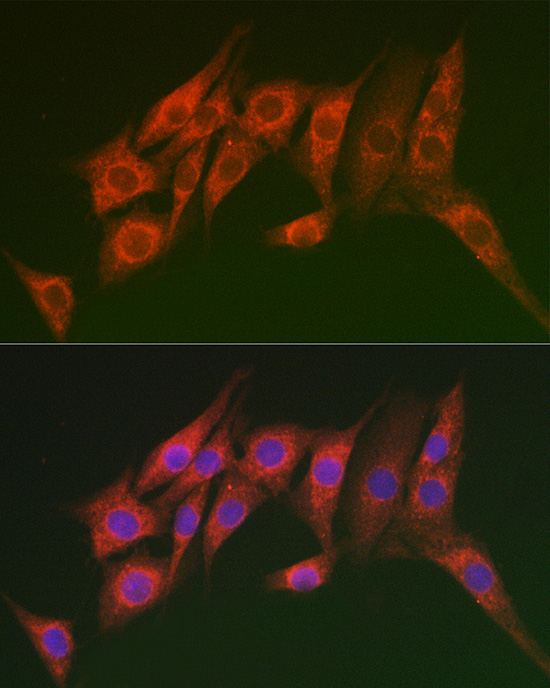 MTMR14 Rabbit Polyclonal Antibody - Image 2