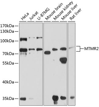 MTMR2 Rabbit Polyclonal Antibody