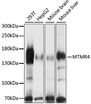 MTMR4 Rabbit Polyclonal Antibody