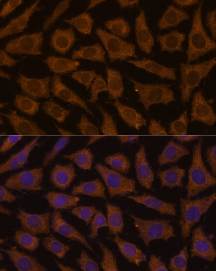 MTMR4 Rabbit Polyclonal Antibody - Image 2