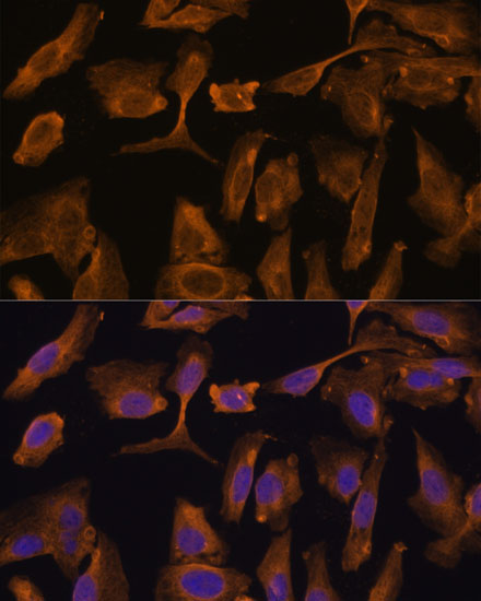 MTMR4 Rabbit Polyclonal Antibody - Image 3