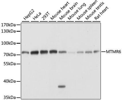 MTMR6 Rabbit Polyclonal Antibody