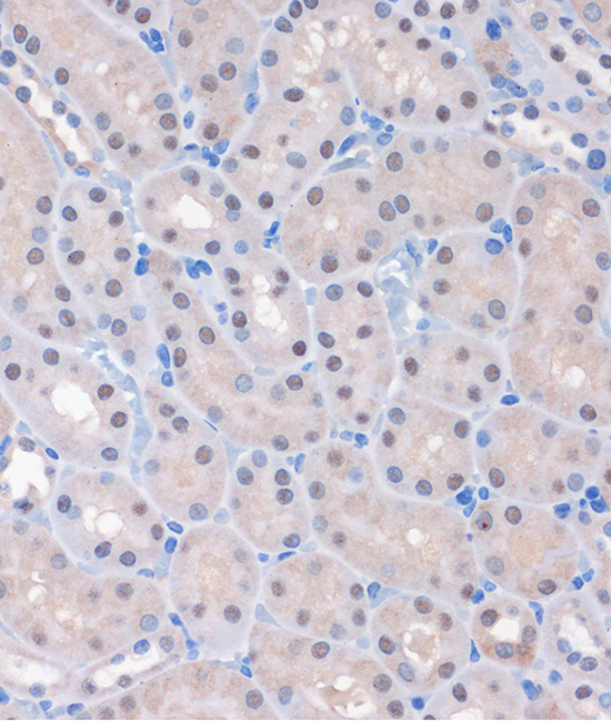 MTMR8 Rabbit Polyclonal Antibody - Image 2