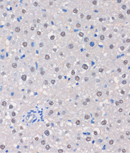 MTMR8 Rabbit Polyclonal Antibody - Image 3