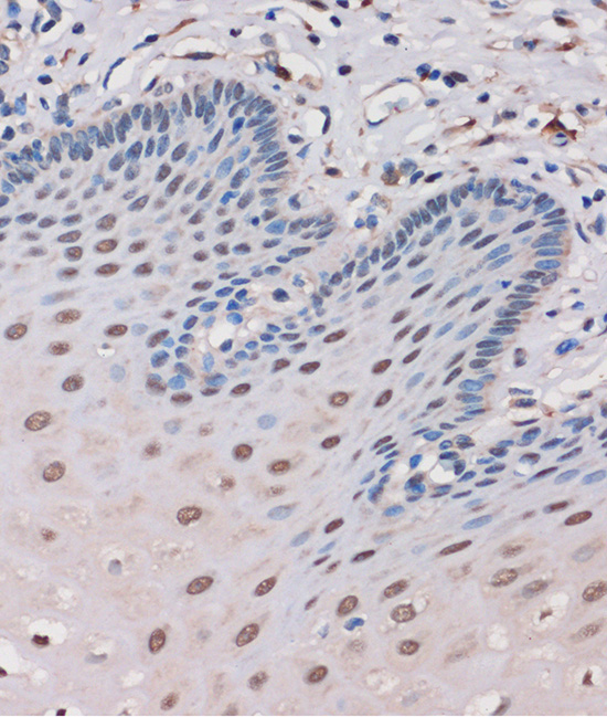 MTMR8 Rabbit Polyclonal Antibody - Image 4