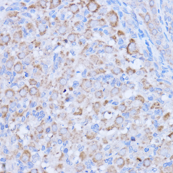 MT-ND1 Rabbit Polyclonal Antibody - Image 2