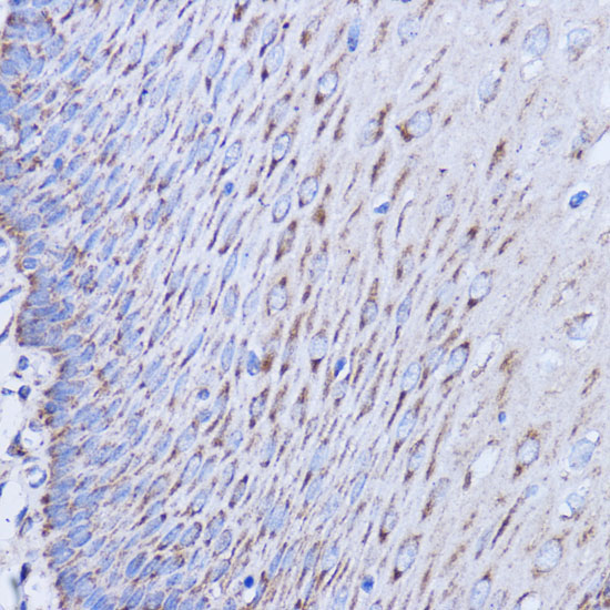 MT-ND1 Rabbit Polyclonal Antibody - Image 3