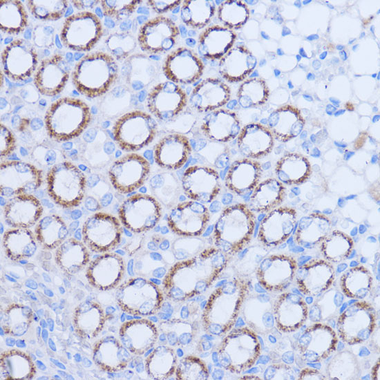 MT-ND1 Rabbit Polyclonal Antibody - Image 4