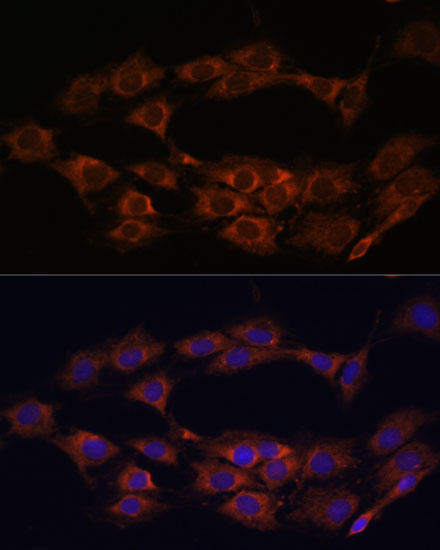 MT-ND1 Rabbit Polyclonal Antibody - Image 5