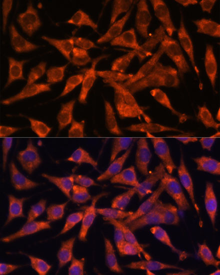 MT-ND1 Rabbit Polyclonal Antibody - Image 6