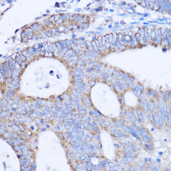 MT-ND3 Rabbit Polyclonal Antibody - Image 2