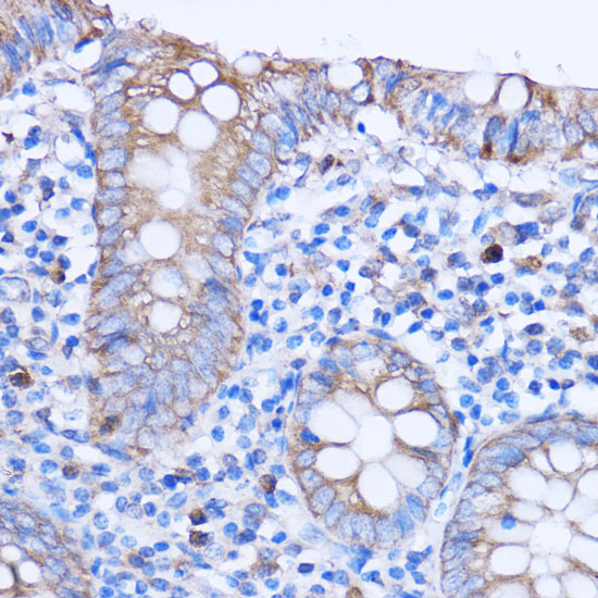 MT-ND3 Rabbit Polyclonal Antibody - Image 3