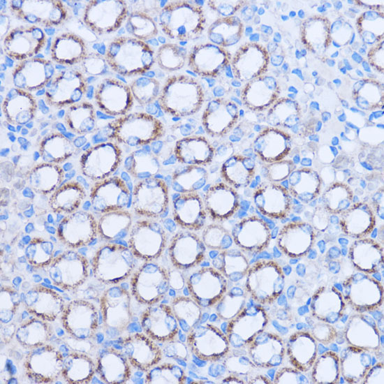 MT-ND3 Rabbit Polyclonal Antibody - Image 4