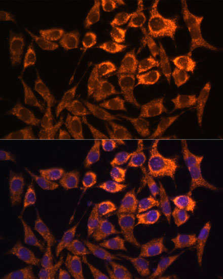 MT-ND3 Rabbit Polyclonal Antibody - Image 5