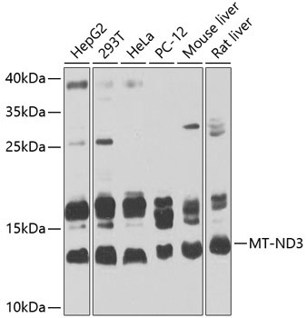 MT-ND3 Rabbit Polyclonal Antibody
