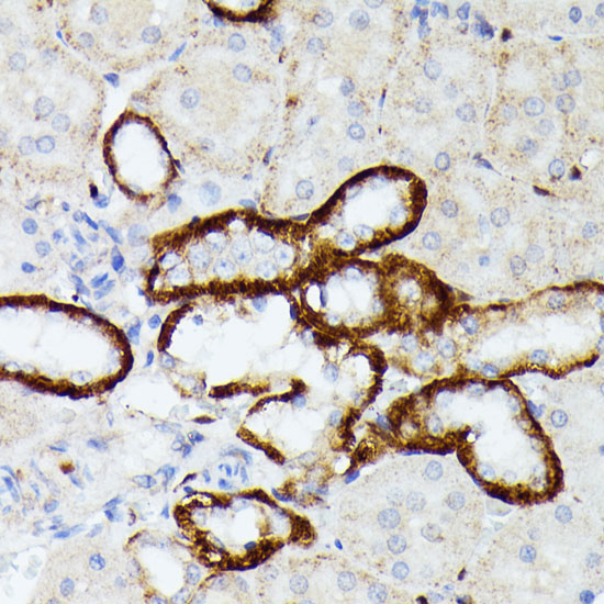 MT-ND5 Rabbit Polyclonal Antibody - Image 2