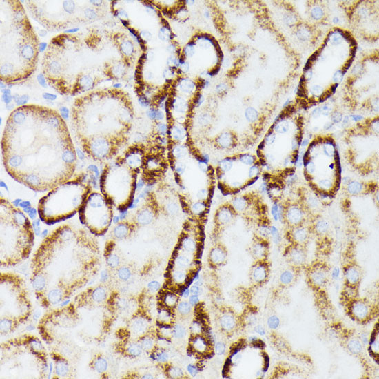 MT-ND5 Rabbit Polyclonal Antibody - Image 4