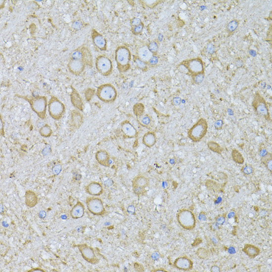 MTNR1A Rabbit Polyclonal Antibody - Image 2