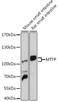MTTP Rabbit Polyclonal Antibody