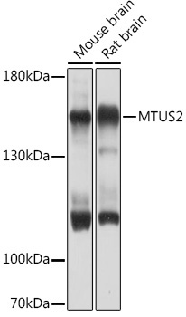 MTUS2 Rabbit Polyclonal Antibody