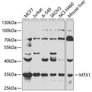 MTX1 Rabbit Polyclonal Antibody