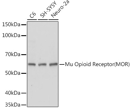 Mu Opioid Receptor(MOR) Rabbit Polyclonal Antibody