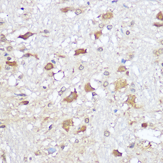 Mu Opioid Receptor(MOR) Rabbit Polyclonal Antibody - Image 2