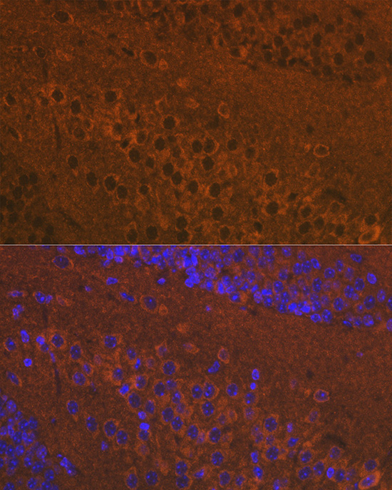 Mu Opioid Receptor(MOR) Rabbit Polyclonal Antibody - Image 3
