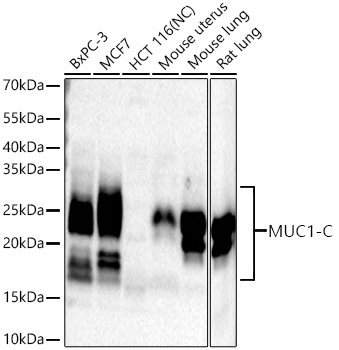MUC1 Rabbit Monoclonal Antibody