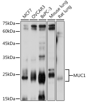 MUC1 Rabbit Polyclonal Antibody