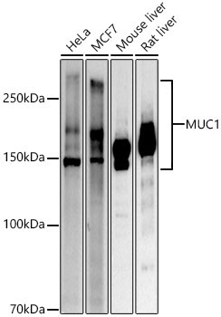 MUC1 Rabbit Polyclonal Antibody